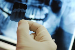 рентген зуба при беременности