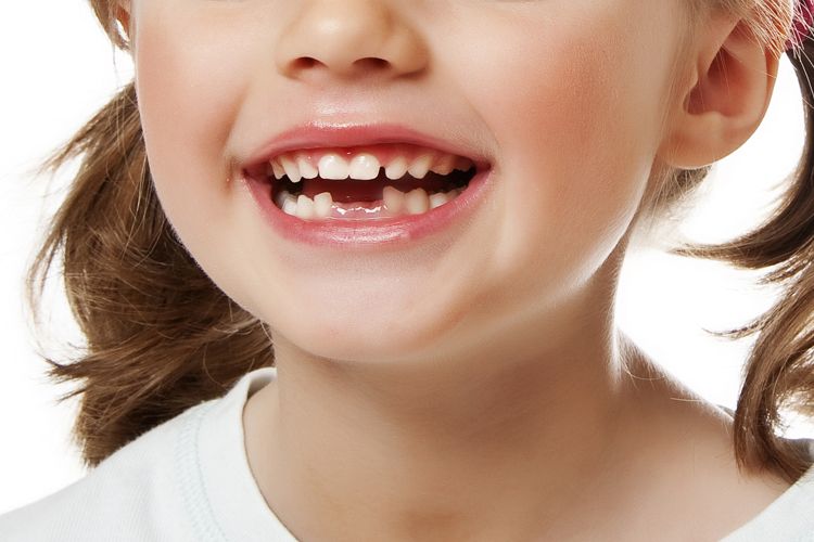 Гнилые зубы у ребенка